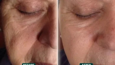 Facelift in Dubai
