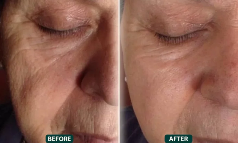 Facelift in Dubai